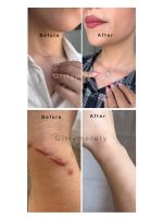 ژل ترمیم کننده لانبنا - تصویر 2
